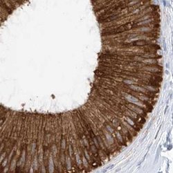 RCN2 Antibody, Novus Biologicals:Antibodies:Primary Antibodies